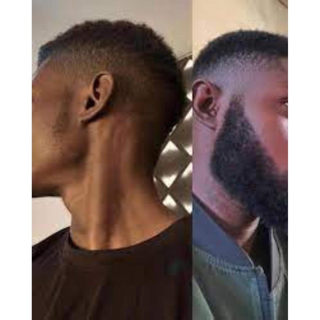 Hair Extra Boost Minox 5% (with Biotin) 1 month